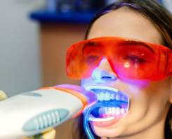 Teeth Whitening Cost Adelaide