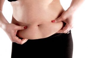 Central Surgery tummy tuck Adelaide